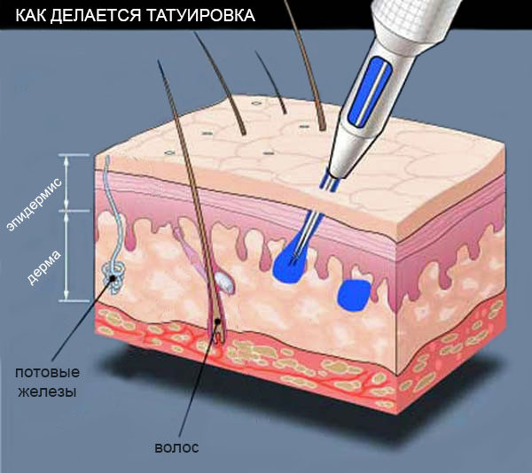 C:\Users\Юлия\AppData\Local\Microsoft\Windows\INetCache\Content.Word\Глубина проникновения иглы.jpg